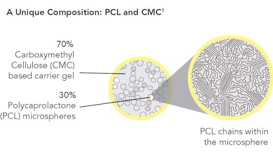 Grafik zur Ellanse Dermafilter Verbindung von PCL und CMC