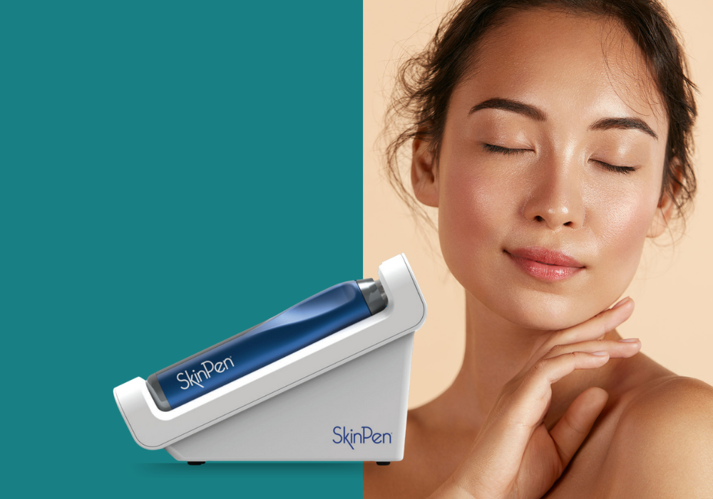 Teaser Microneedling SkinPen